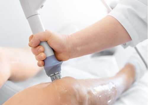 ESWT (Extracorporeal Shock Wave Therapy) Tedavisi